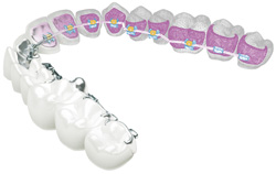 harmony-orthodontic-system